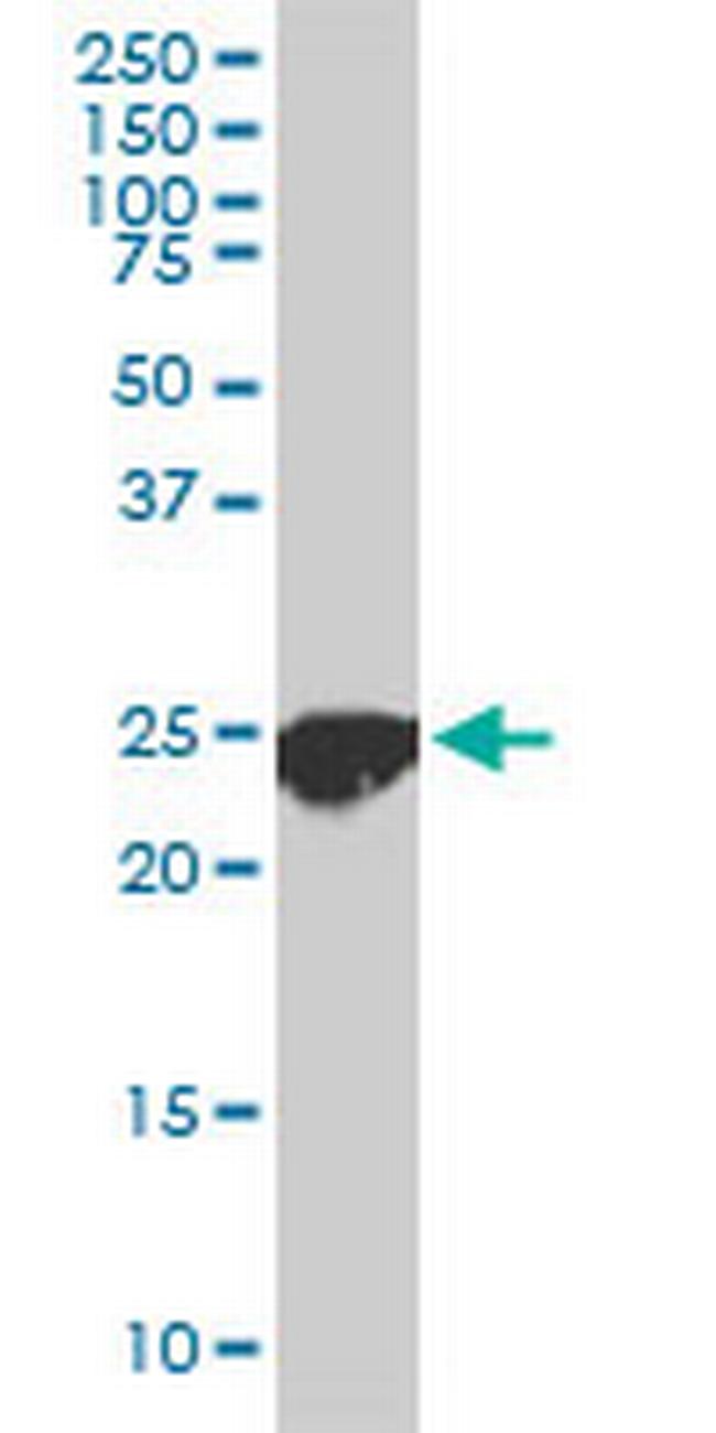 CLPP Antibody in Western Blot (WB)