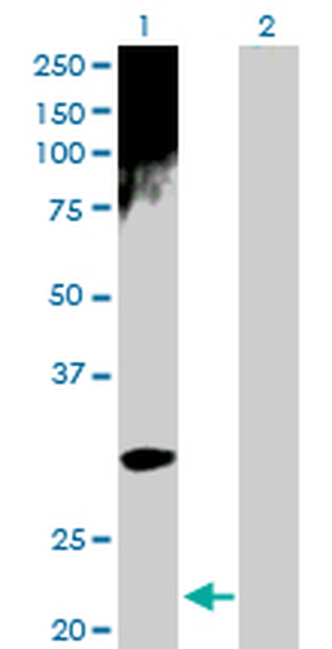 ARD1A Antibody in Western Blot (WB)