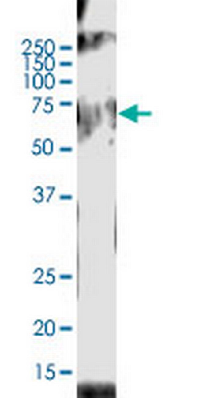 ACOX2 Antibody in Western Blot (WB)