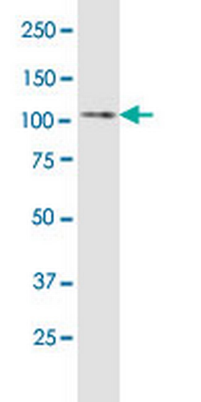 ULK1 Antibody in Western Blot (WB)