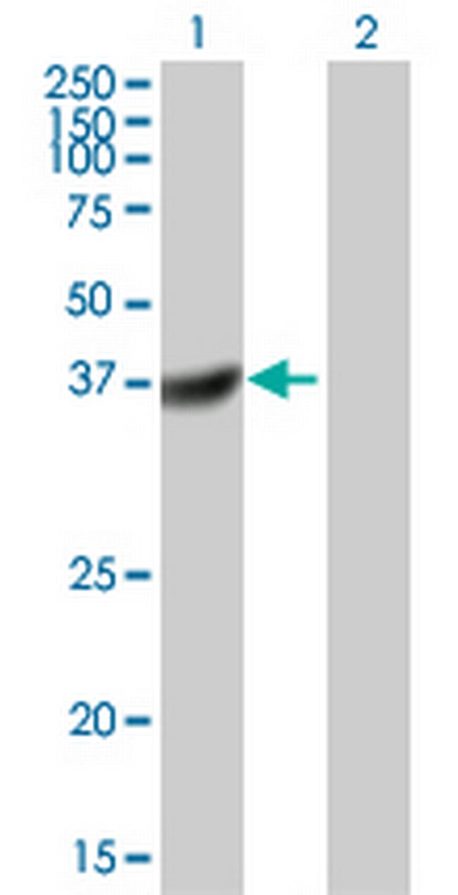 DUSP11 Antibody in Western Blot (WB)