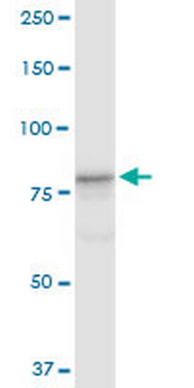 CUL4A Antibody in Western Blot (WB)