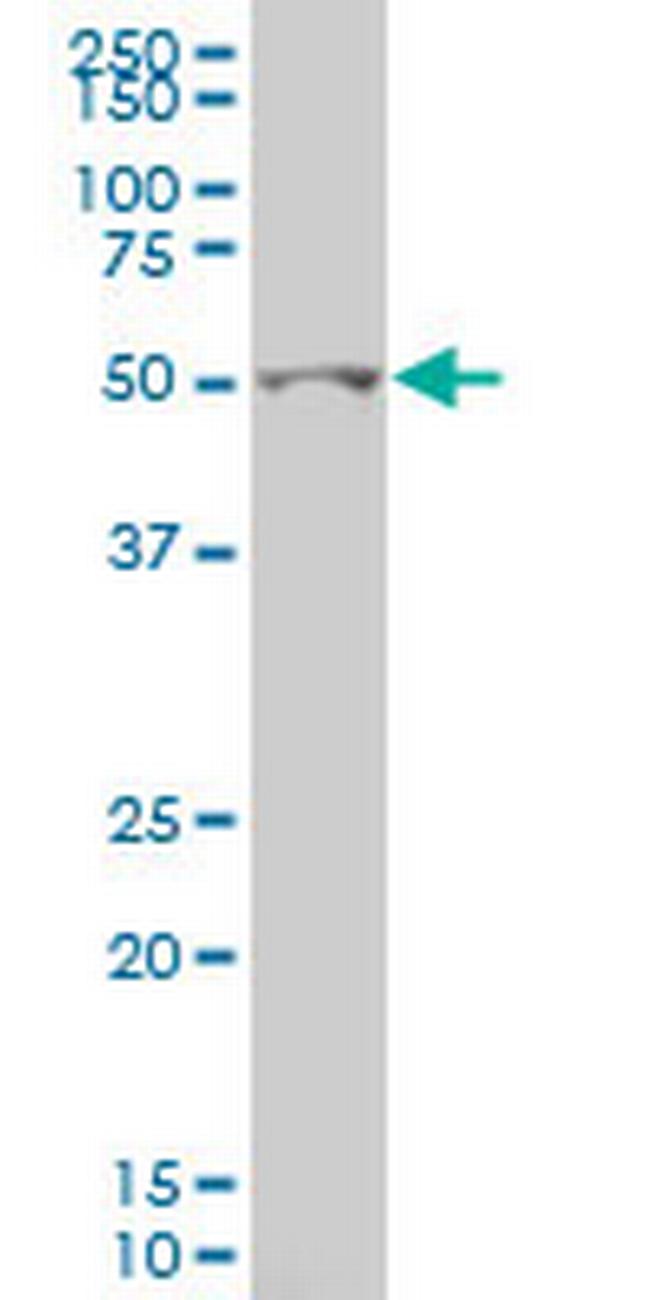 GCM1 Antibody in Western Blot (WB)