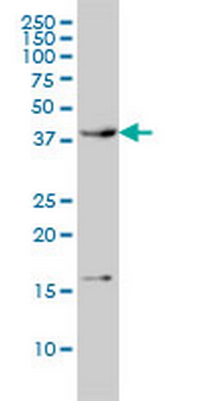 CAMK1 Antibody in Western Blot (WB)