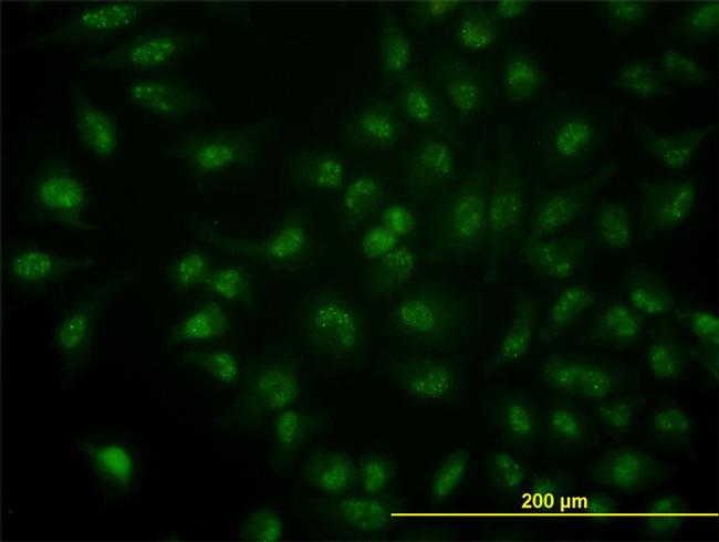 CDC14A Antibody in Immunocytochemistry (ICC/IF)