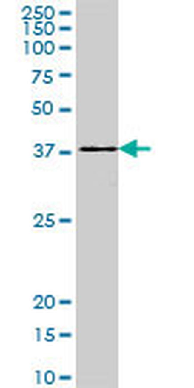 DEGS1 Antibody in Western Blot (WB)