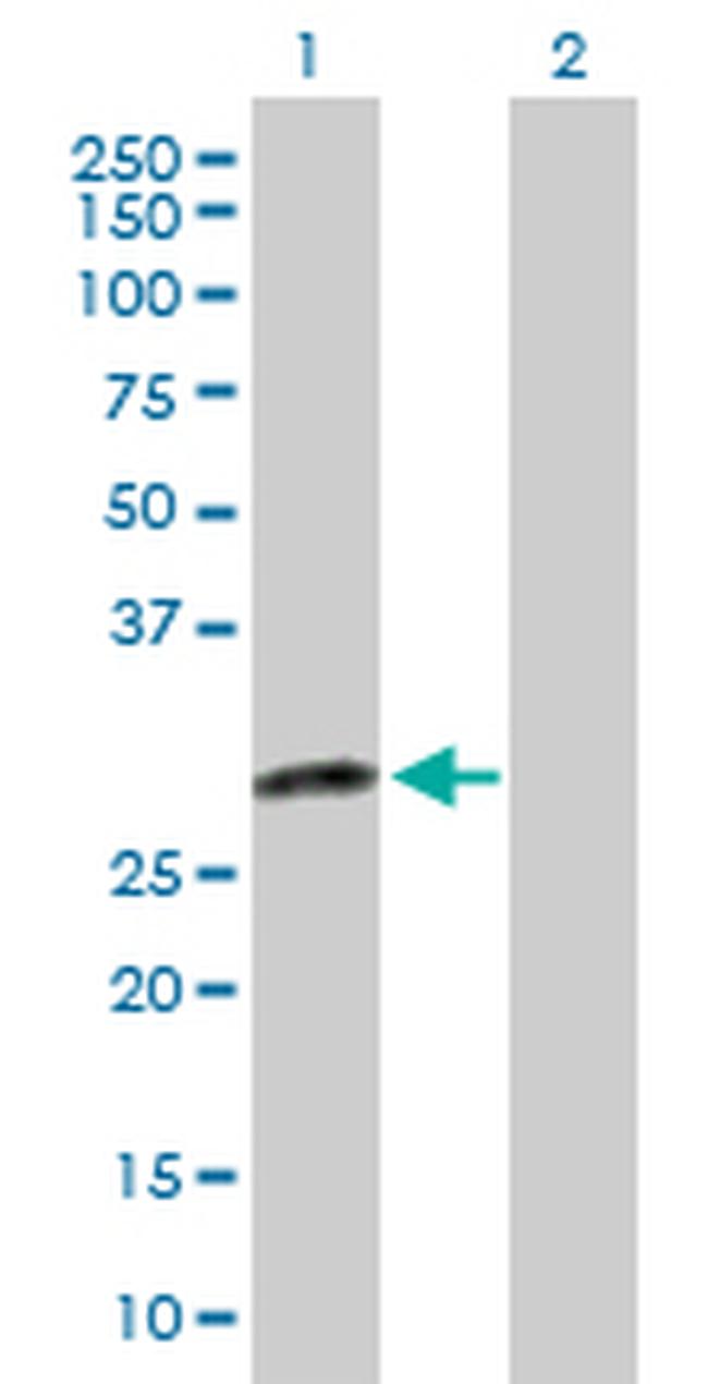 DENR Antibody in Western Blot (WB)