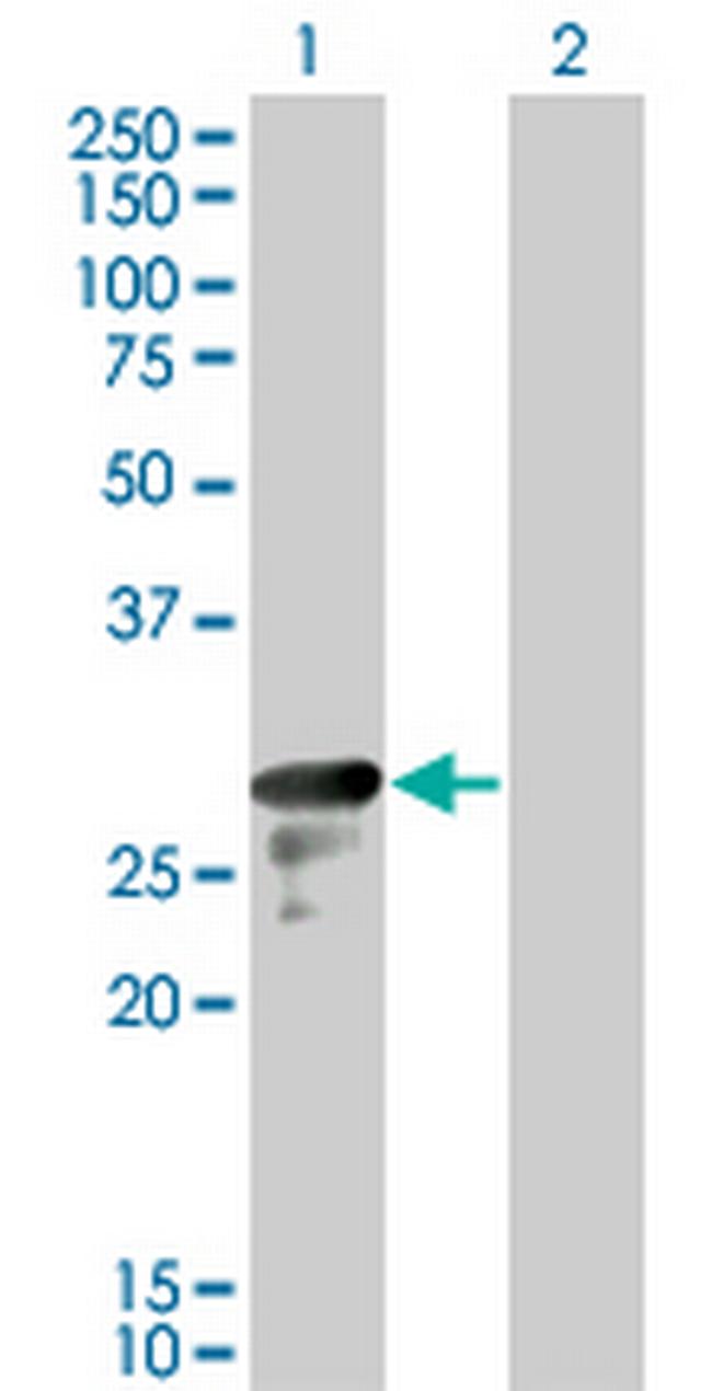 DENR Antibody in Western Blot (WB)