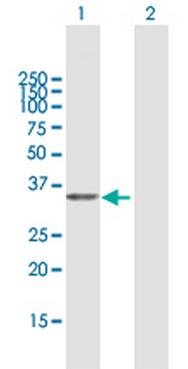 PDXK Antibody in Western Blot (WB)