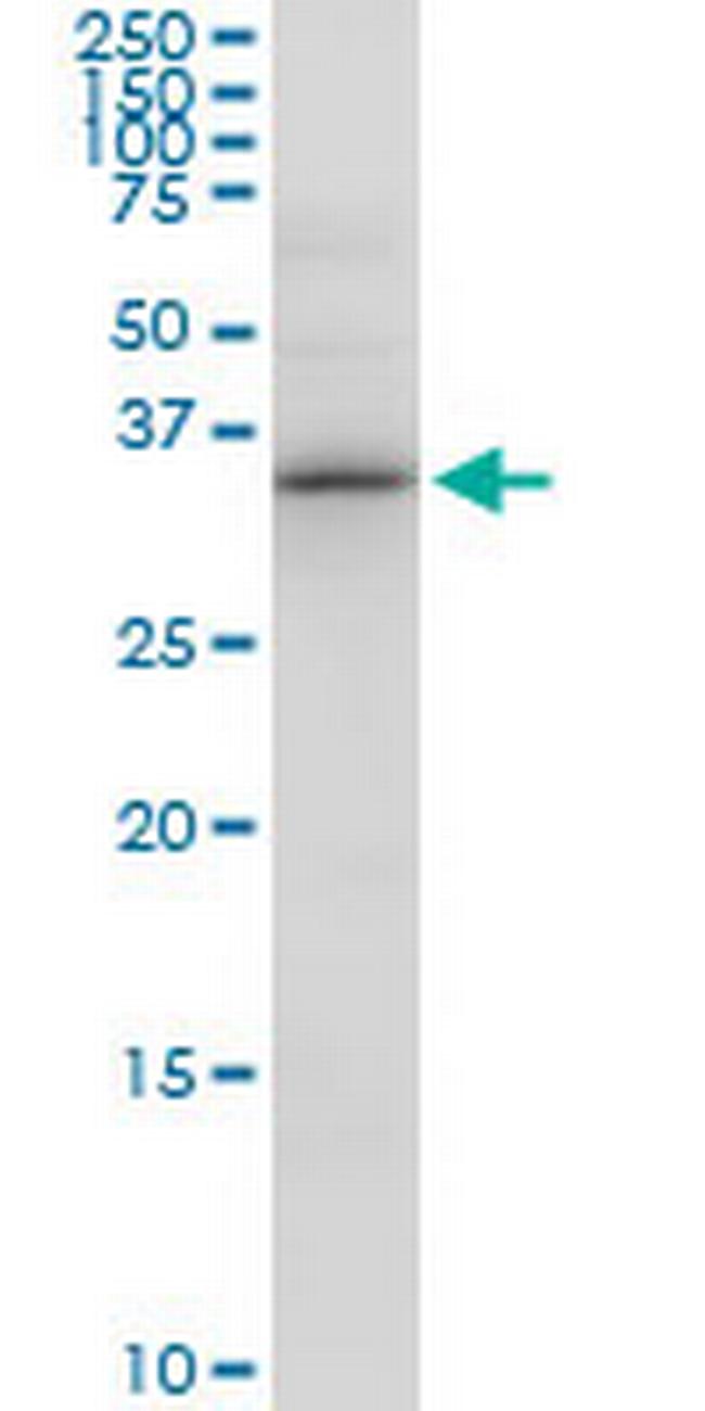 PDXK Antibody in Western Blot (WB)