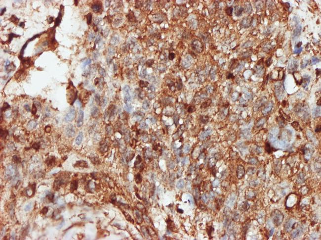 PRKRA Antibody in Immunohistochemistry (Paraffin) (IHC (P))