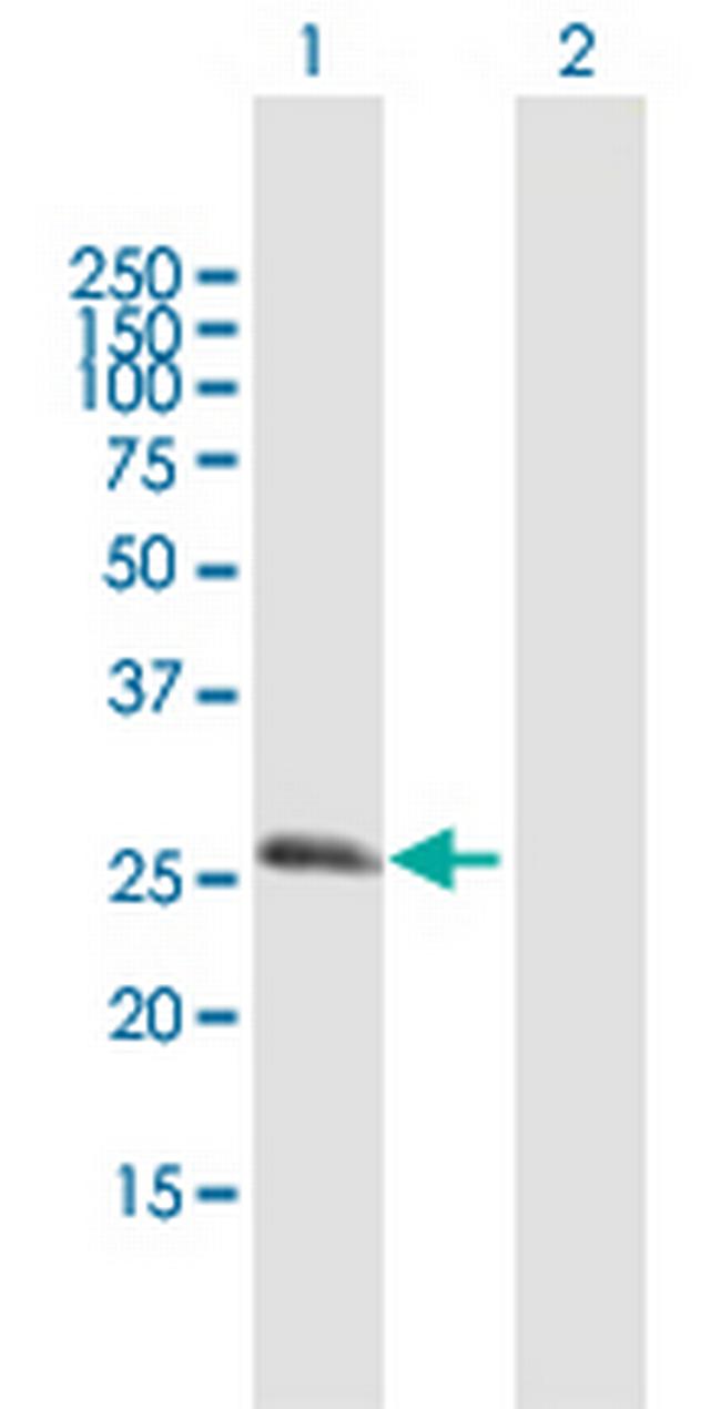 RGS20 Antibody in Western Blot (WB)