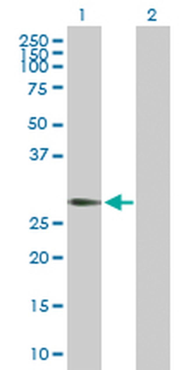 RGS20 Antibody in Western Blot (WB)