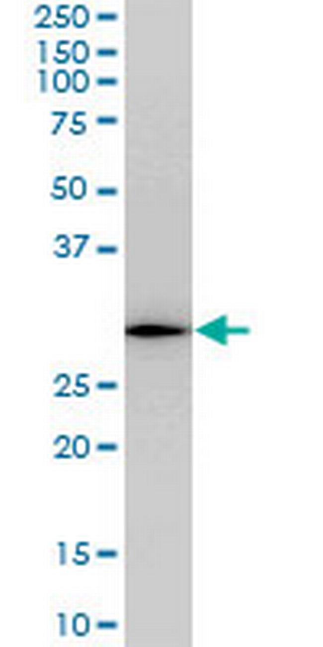 RGS20 Antibody in Western Blot (WB)