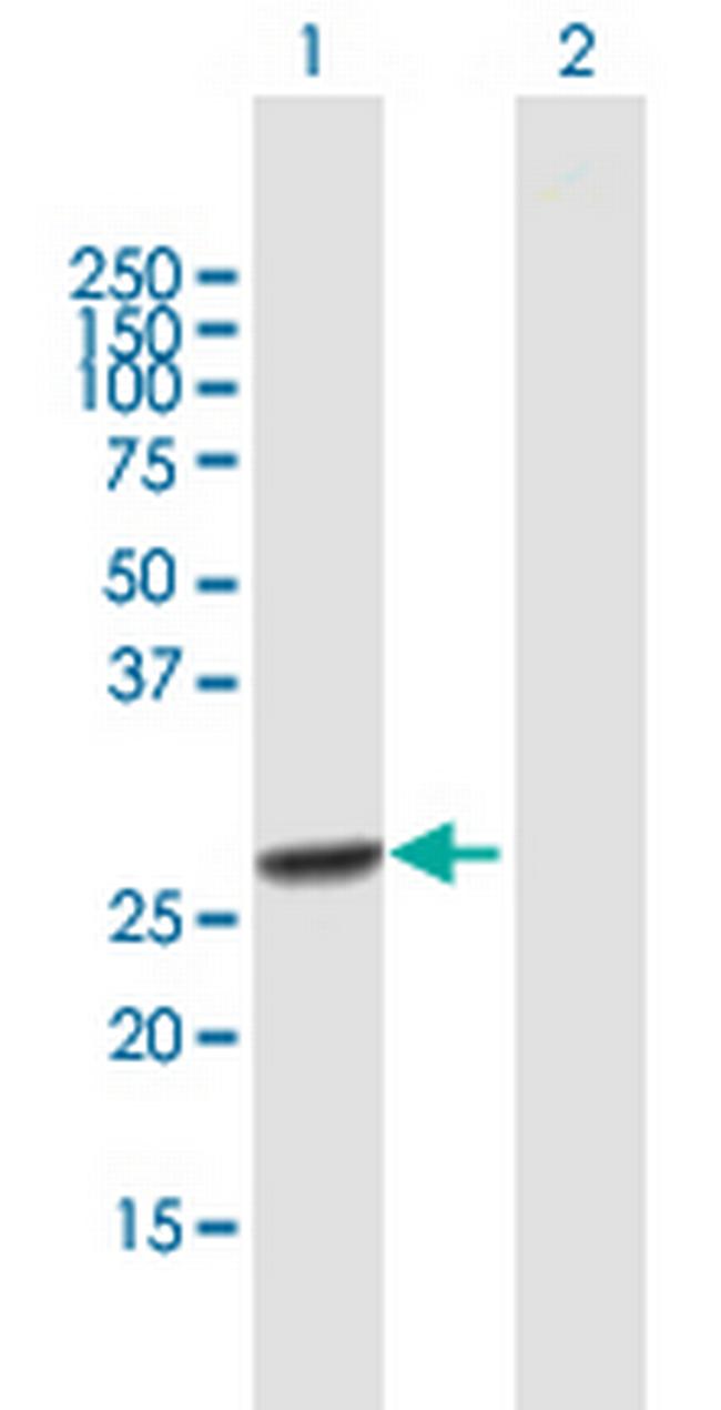 RFXANK Antibody in Western Blot (WB)