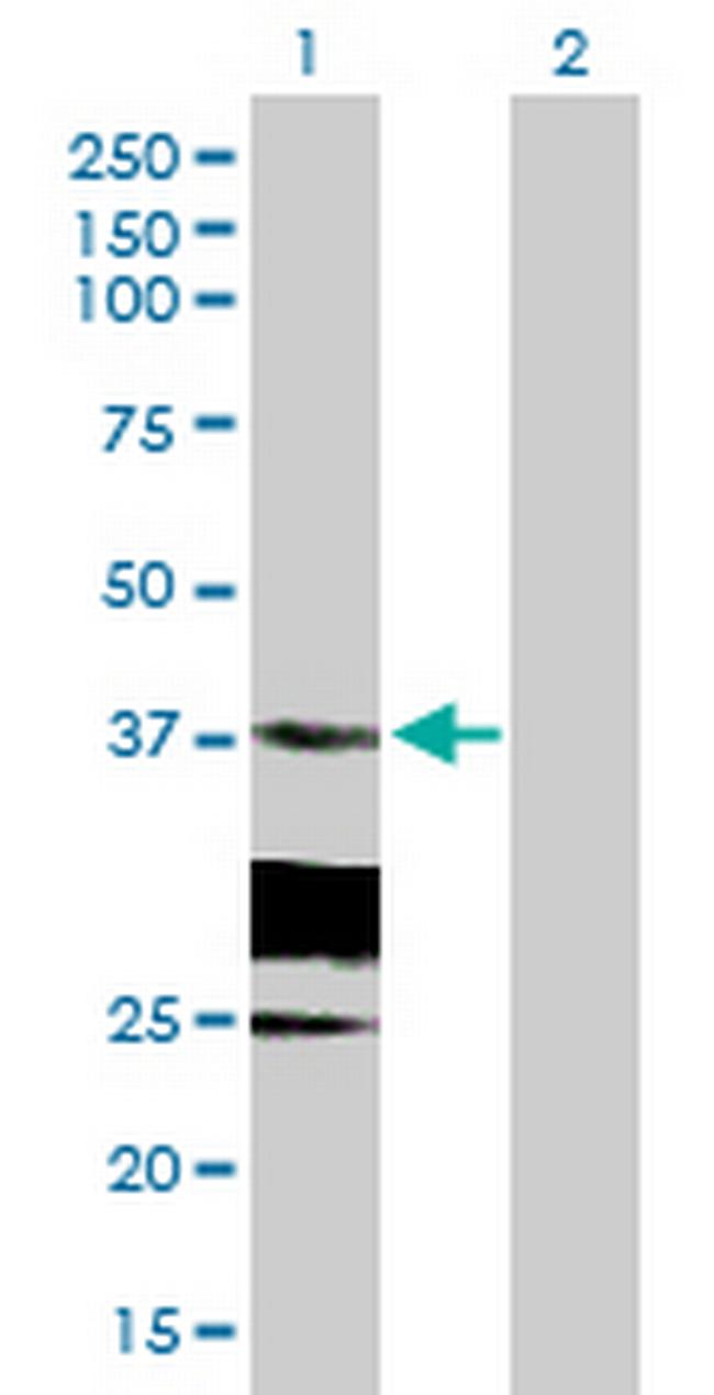 HSD17B6 Antibody in Western Blot (WB)