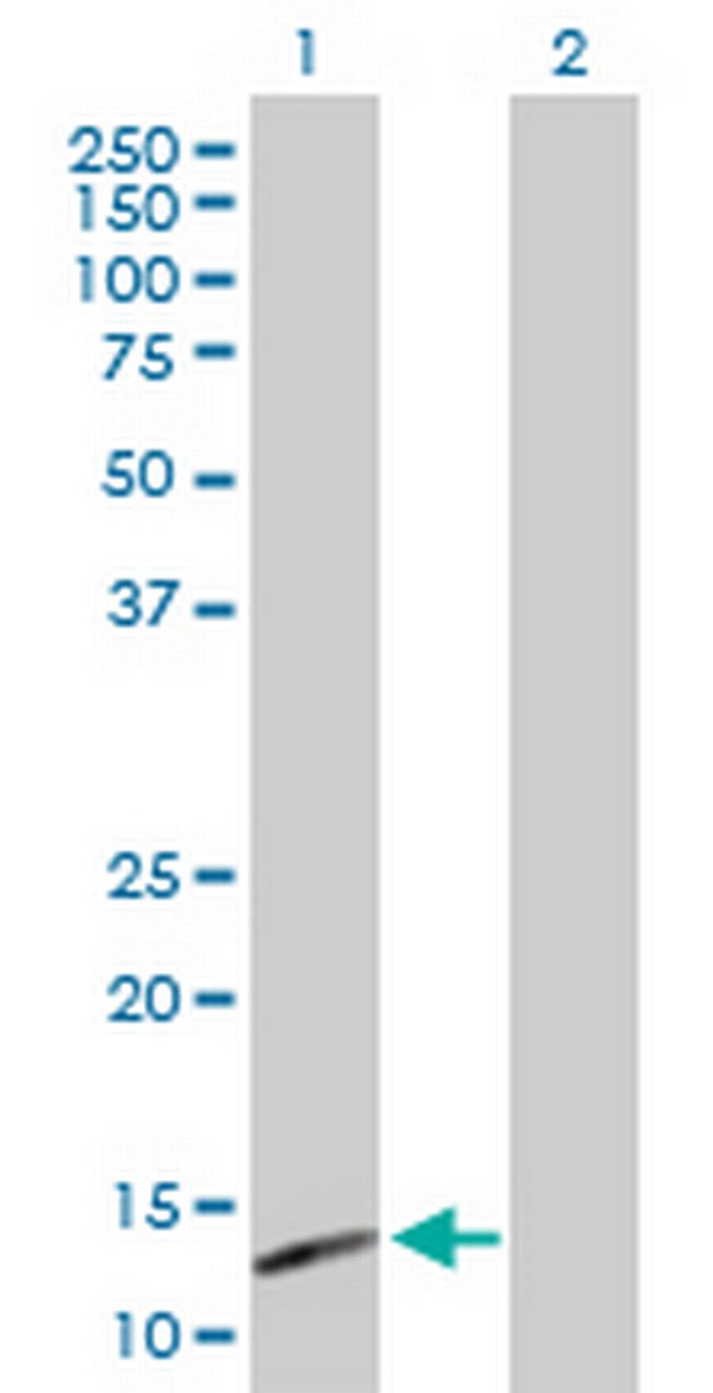 NUMB Antibody in Western Blot (WB)