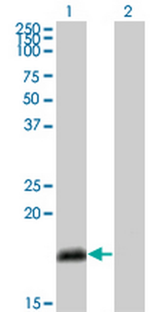 NUMB Antibody in Western Blot (WB)