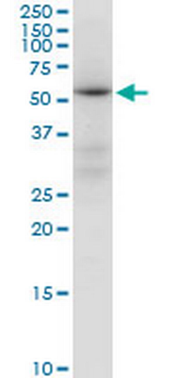 ALDH4A1 Antibody in Western Blot (WB)