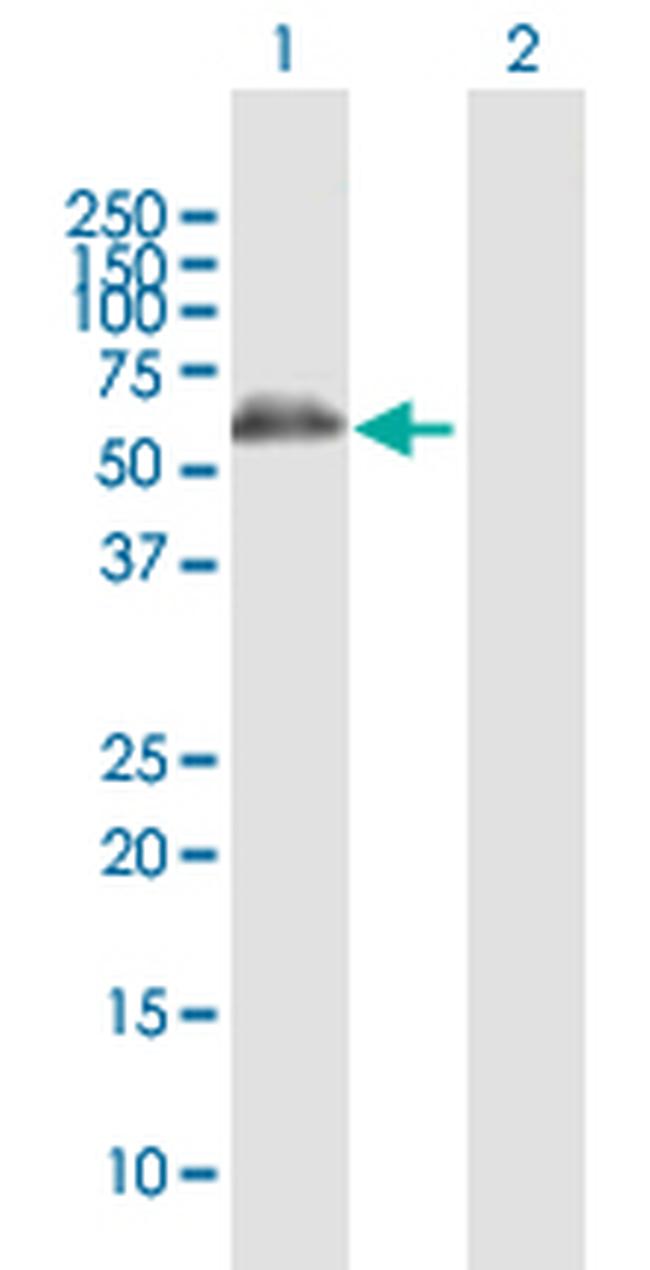 ALDH4A1 Antibody in Western Blot (WB)