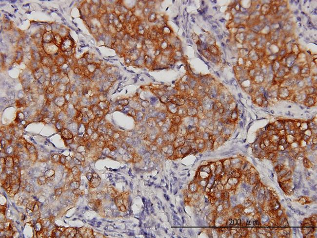 EIF4G3 Antibody in Immunohistochemistry (Paraffin) (IHC (P))