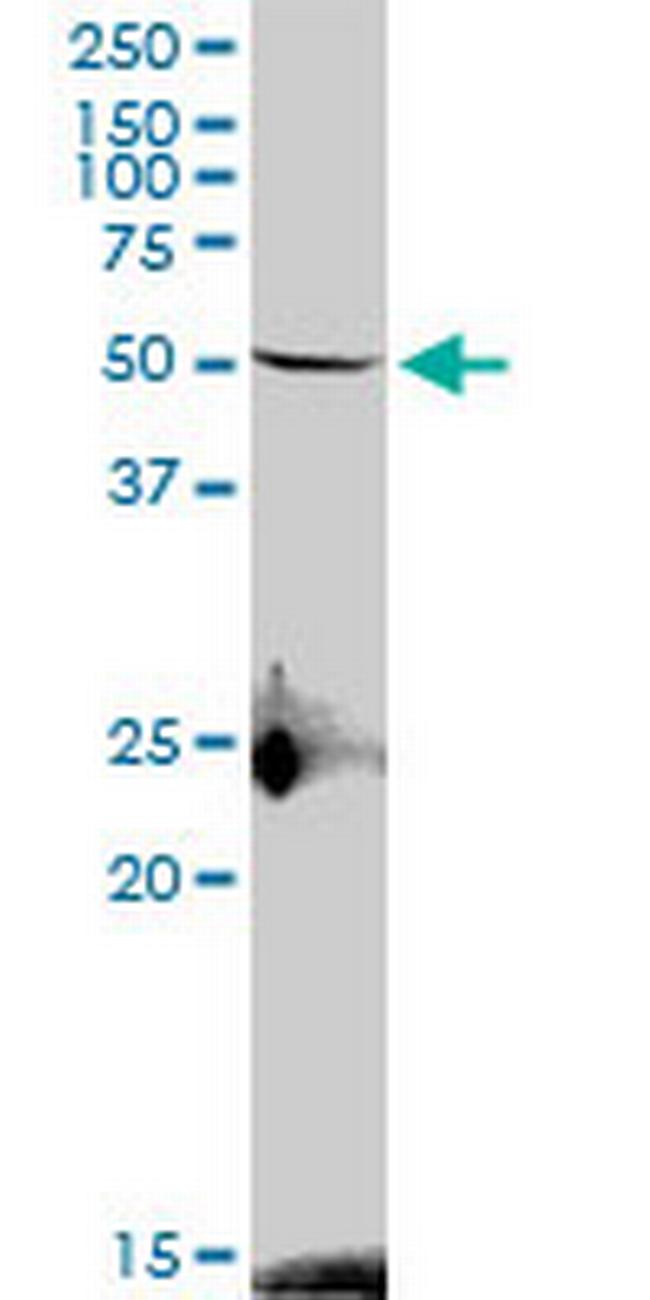 S1PR4 Antibody in Western Blot (WB)