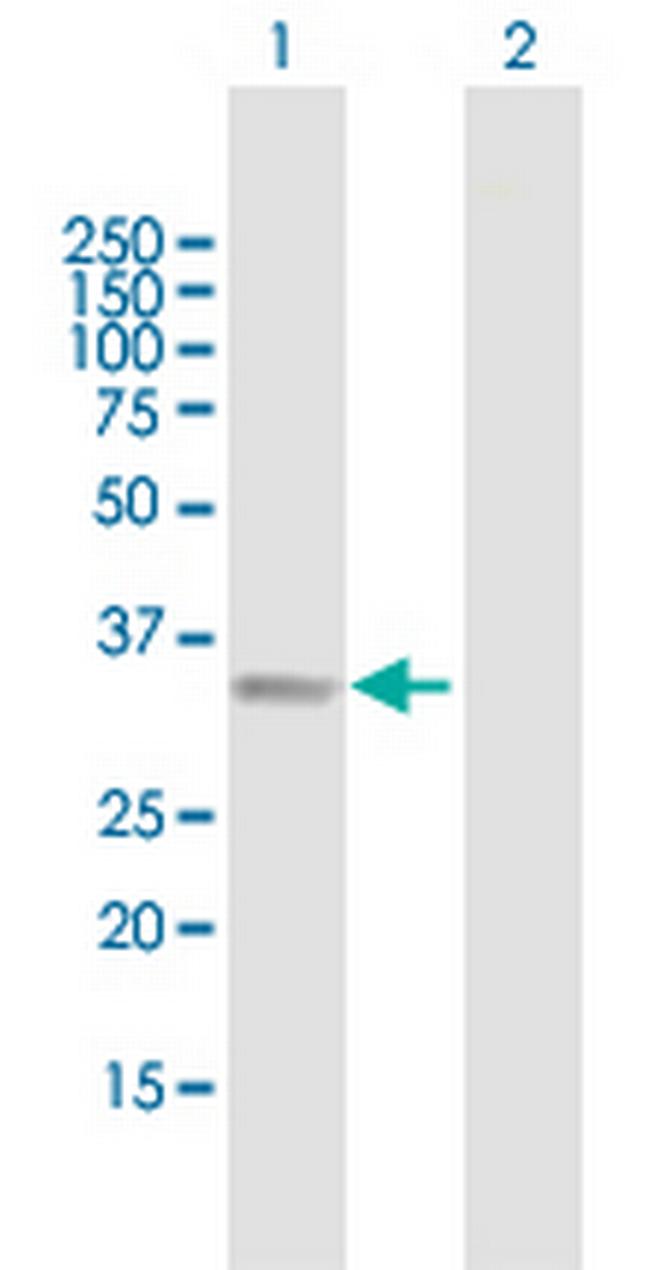 B4GALT2 Antibody in Western Blot (WB)