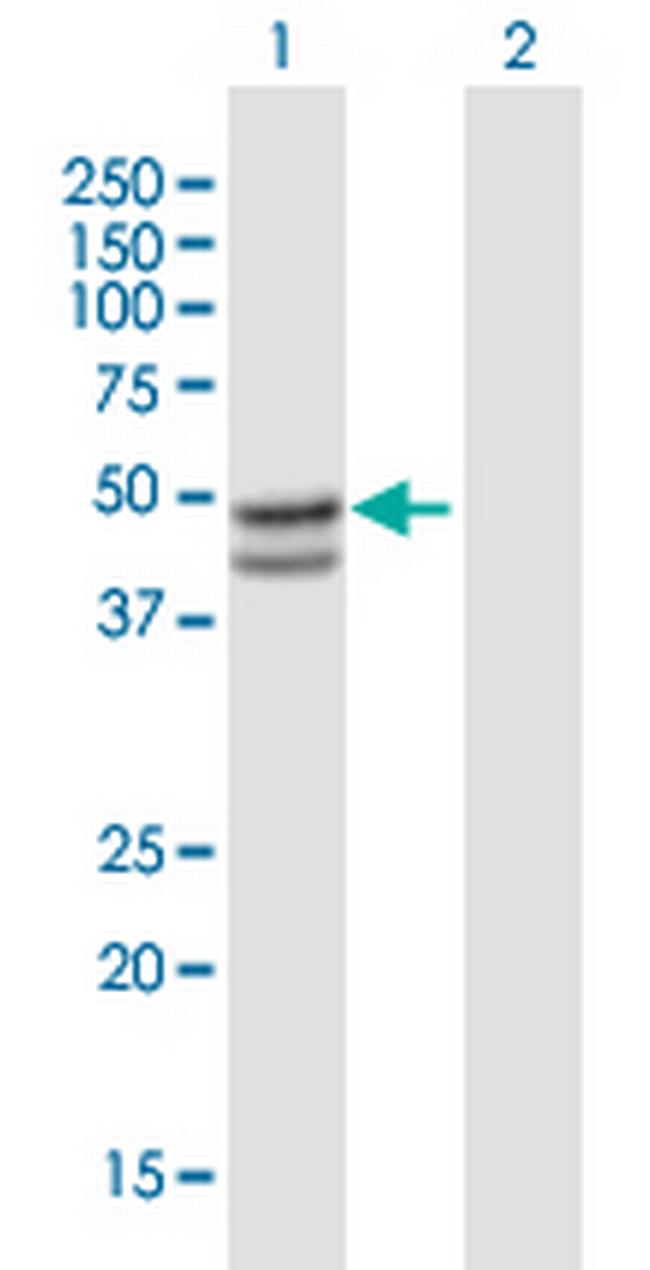 SERPINB7 Antibody in Western Blot (WB)