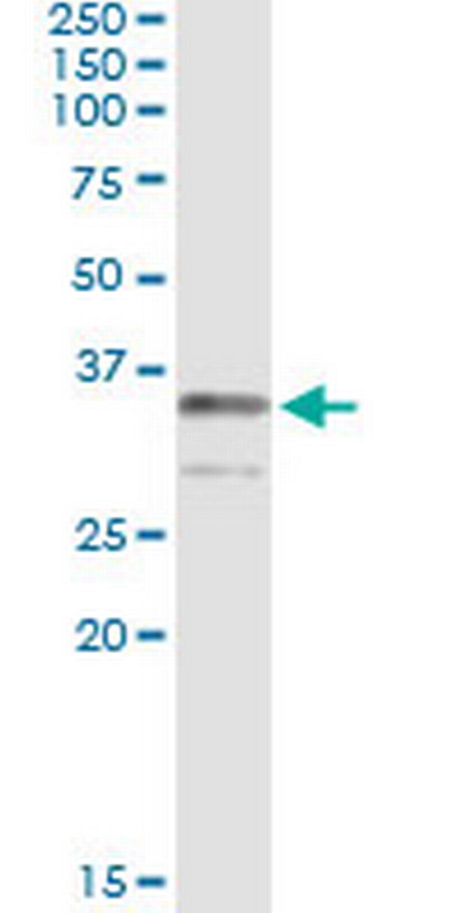 TRADD Antibody in Immunoprecipitation (IP)