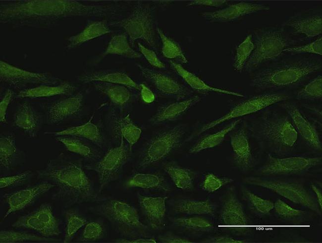 RIPK2 Antibody in Immunocytochemistry (ICC/IF)