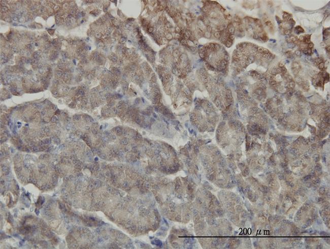 RIPK2 Antibody in Immunohistochemistry (Paraffin) (IHC (P))