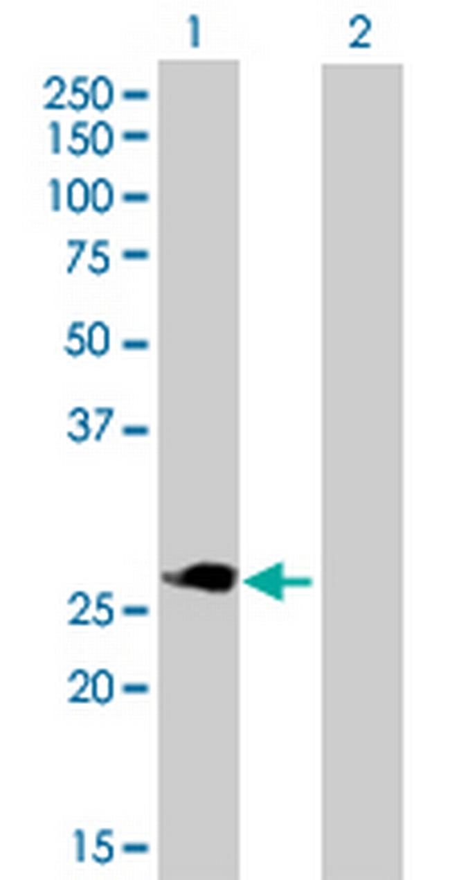 TNFRSF18 Antibody in Western Blot (WB)