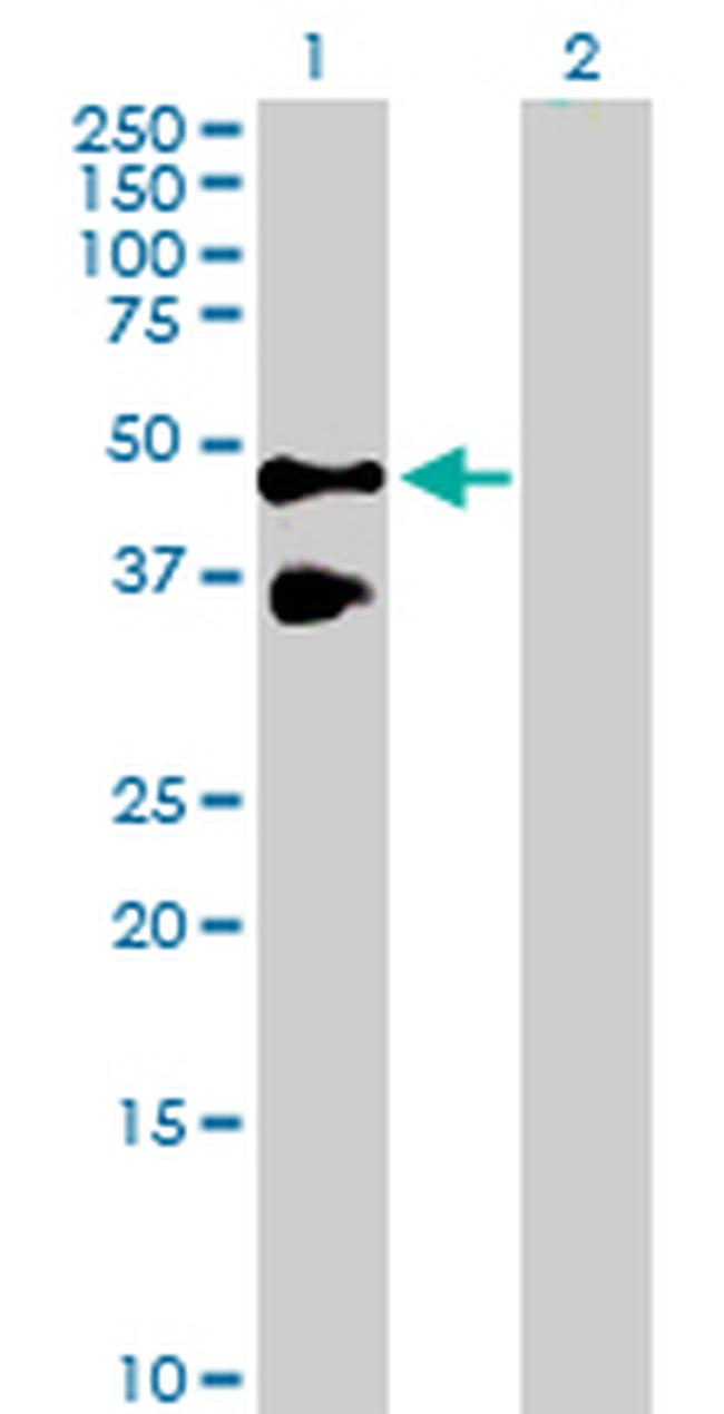 TNFRSF10B Antibody in Western Blot (WB)