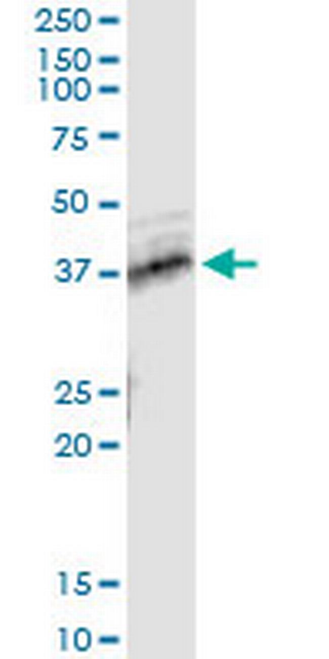 TNFRSF10B Antibody in Immunoprecipitation (IP)