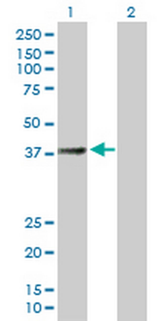 SUCLG2 Antibody in Western Blot (WB)