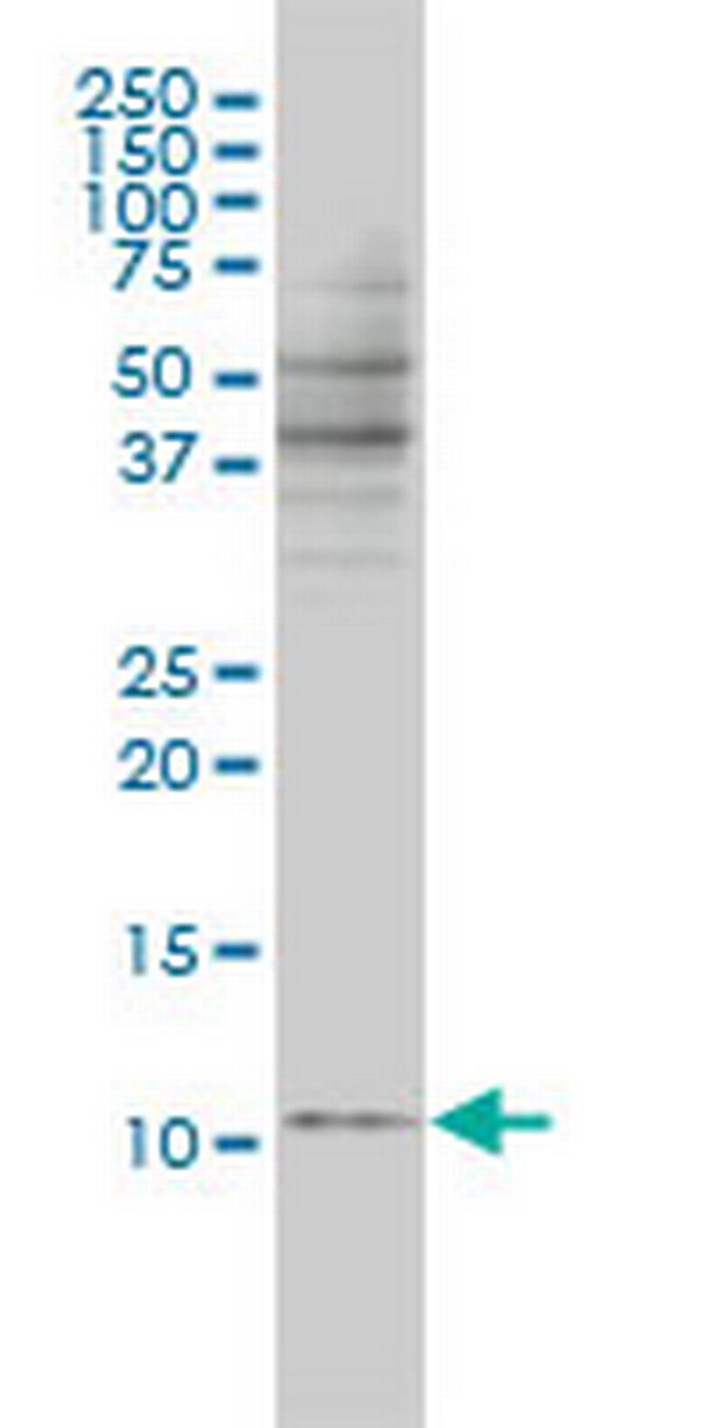 BANF1 Antibody in Western Blot (WB)