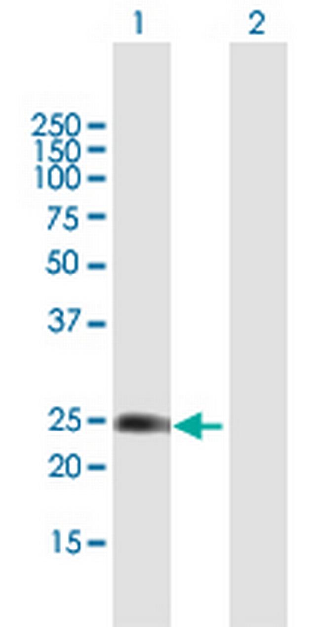 WISP2 Antibody in Western Blot (WB)