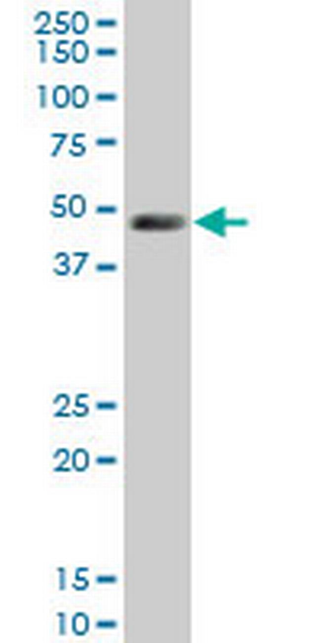 LDB1 Antibody in Western Blot (WB)