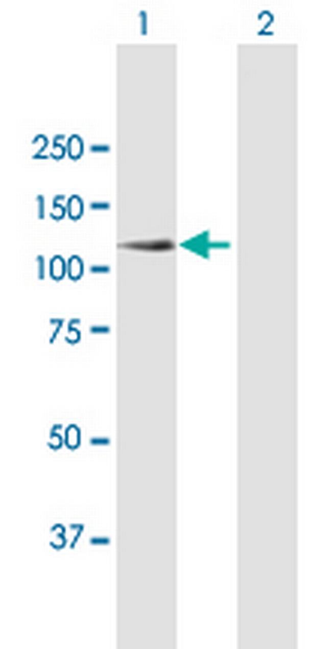 SYNJ2 Antibody in Western Blot (WB)