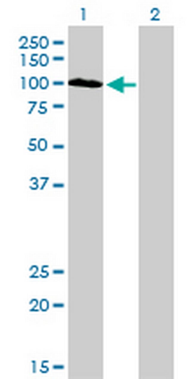 SYNJ2 Antibody in Western Blot (WB)