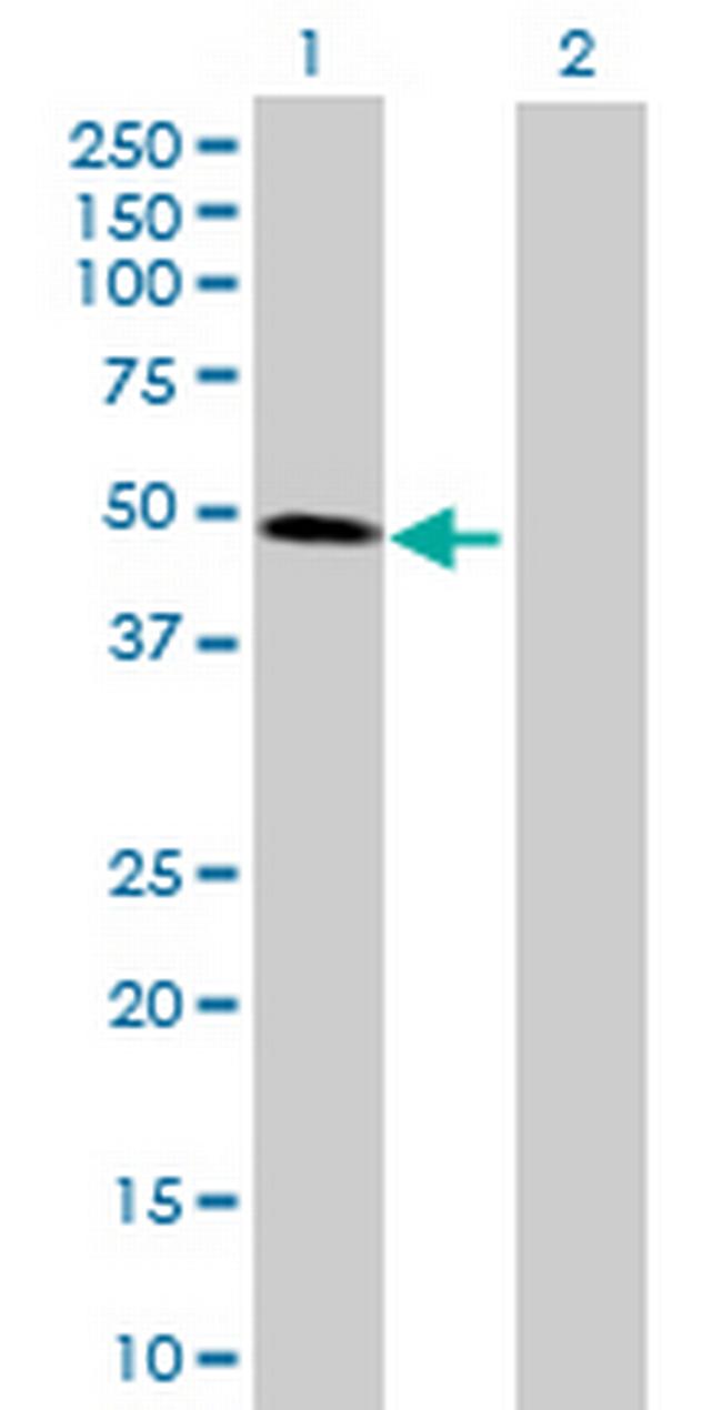 CDC123 Antibody in Western Blot (WB)