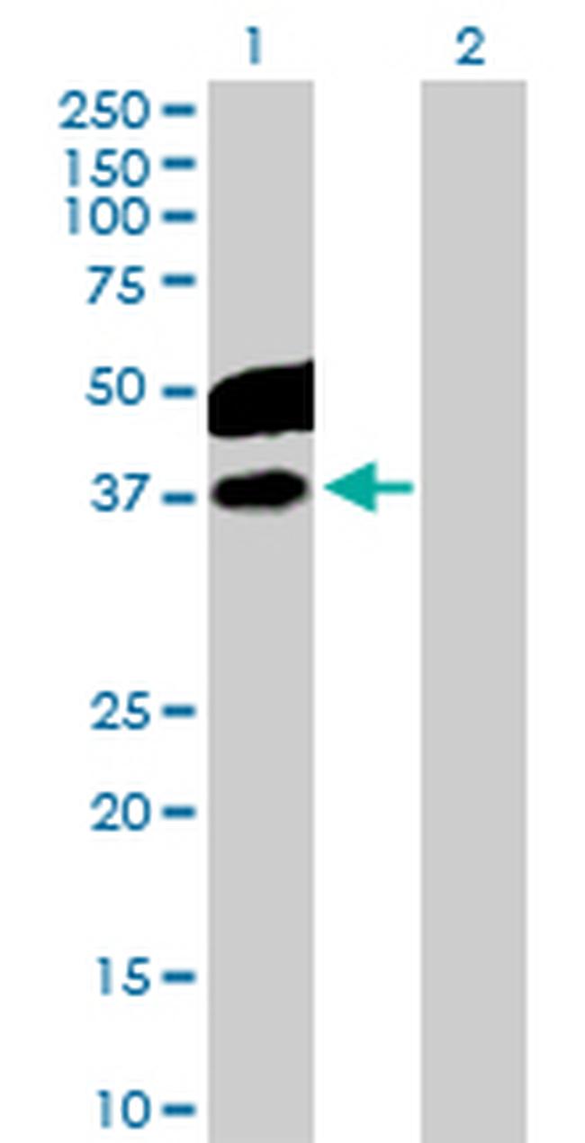 CDC123 Antibody in Western Blot (WB)