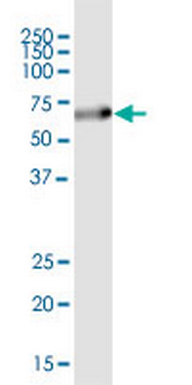 SQSTM1 Antibody in Western Blot (WB)