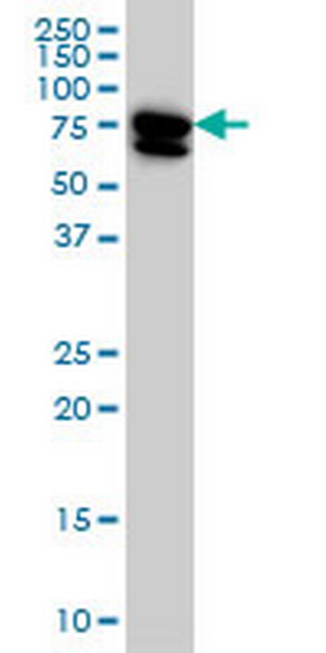 MTMR2 Antibody in Western Blot (WB)