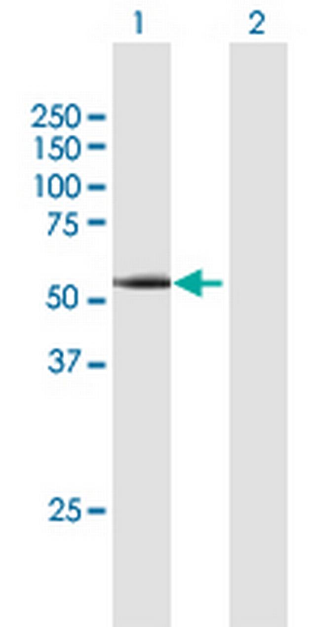 CCNA1 Antibody in Western Blot (WB)