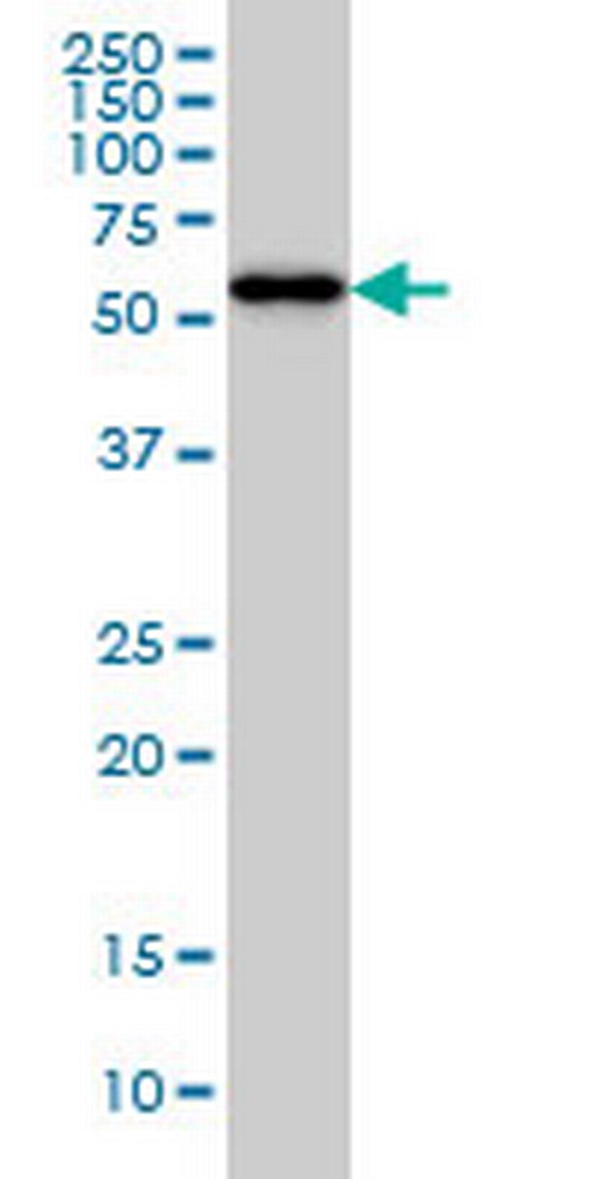 CPNE1 Antibody in Western Blot (WB)