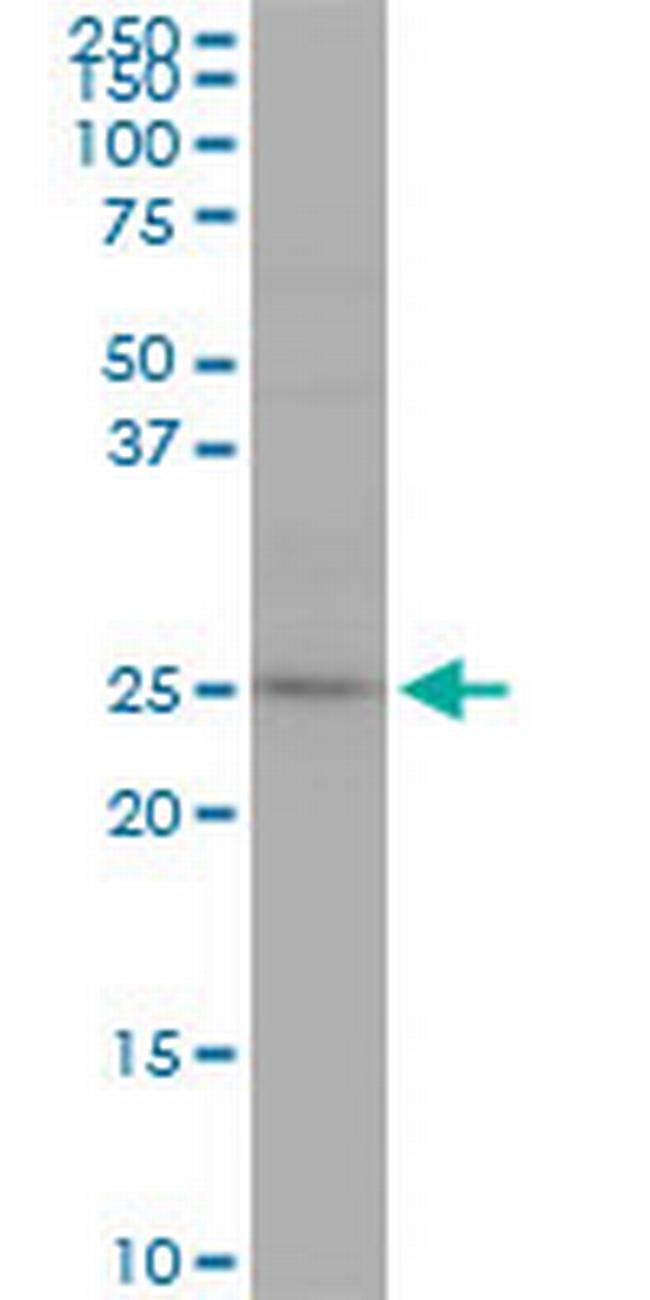 RAB7L1 Antibody in Western Blot (WB)