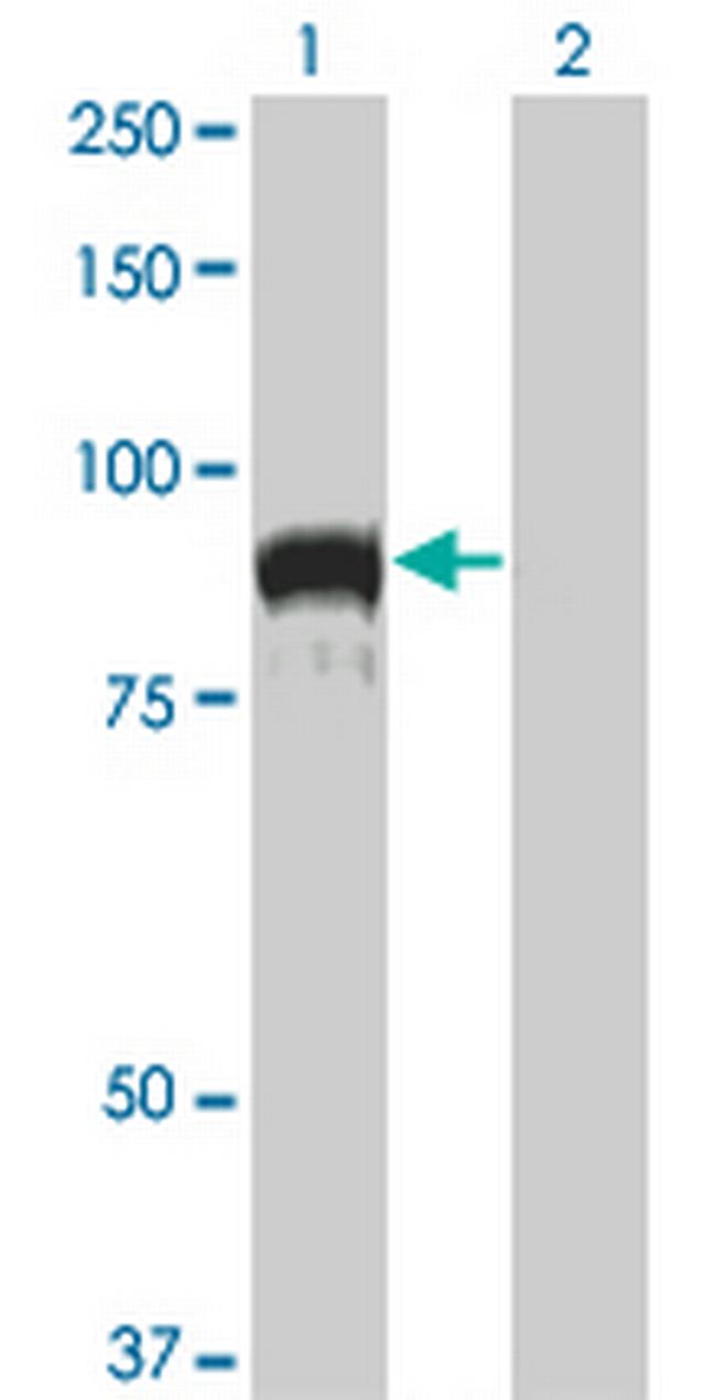 TOP3B Antibody in Western Blot (WB)