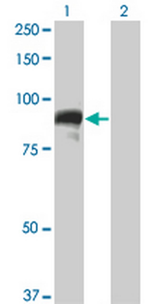 TOP3B Antibody in Western Blot (WB)