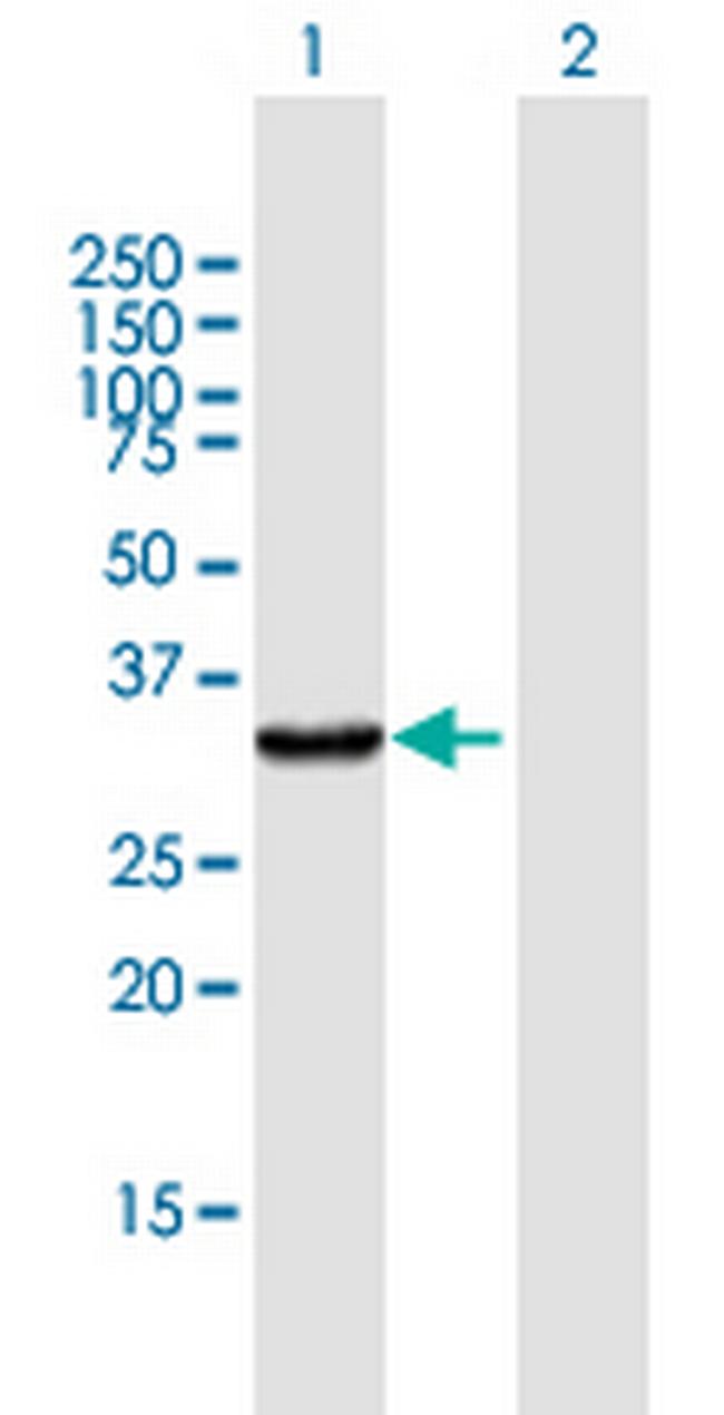 KYNU Antibody in Western Blot (WB)